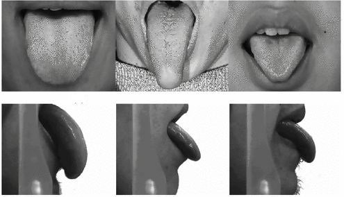 Different shapes of tongues (Image Credit: http://link.springer.com)