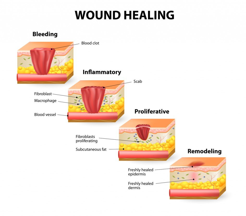 Four Stages of Healing (Photo Credit: designua / Fotolia)