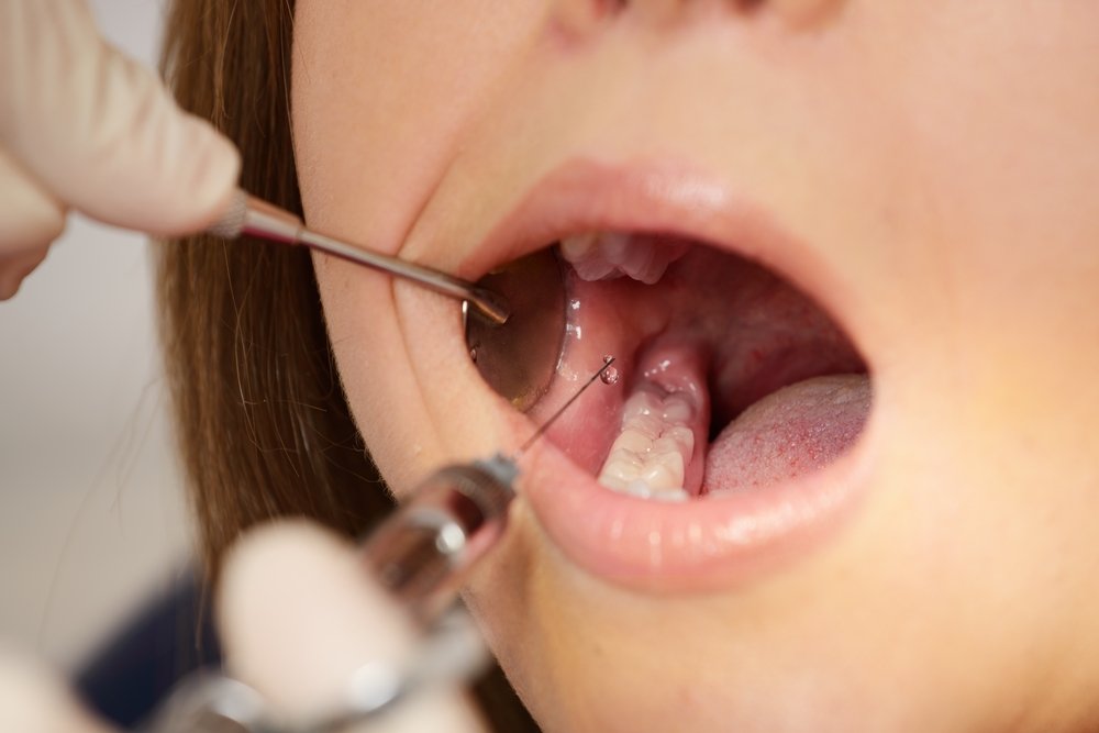 Dentist making anaesthetic injection to woman patient tooth teeth