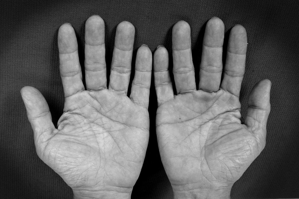 Old man black & white hand palm lines
