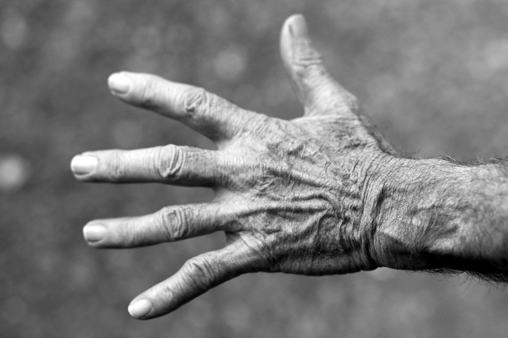 Hand, Elderly Woman, Wrinkles, Black And White