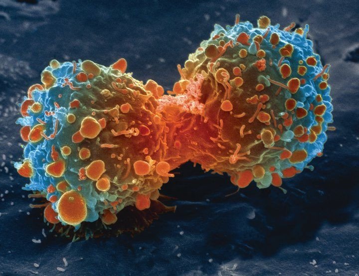 Cancer Cell Division