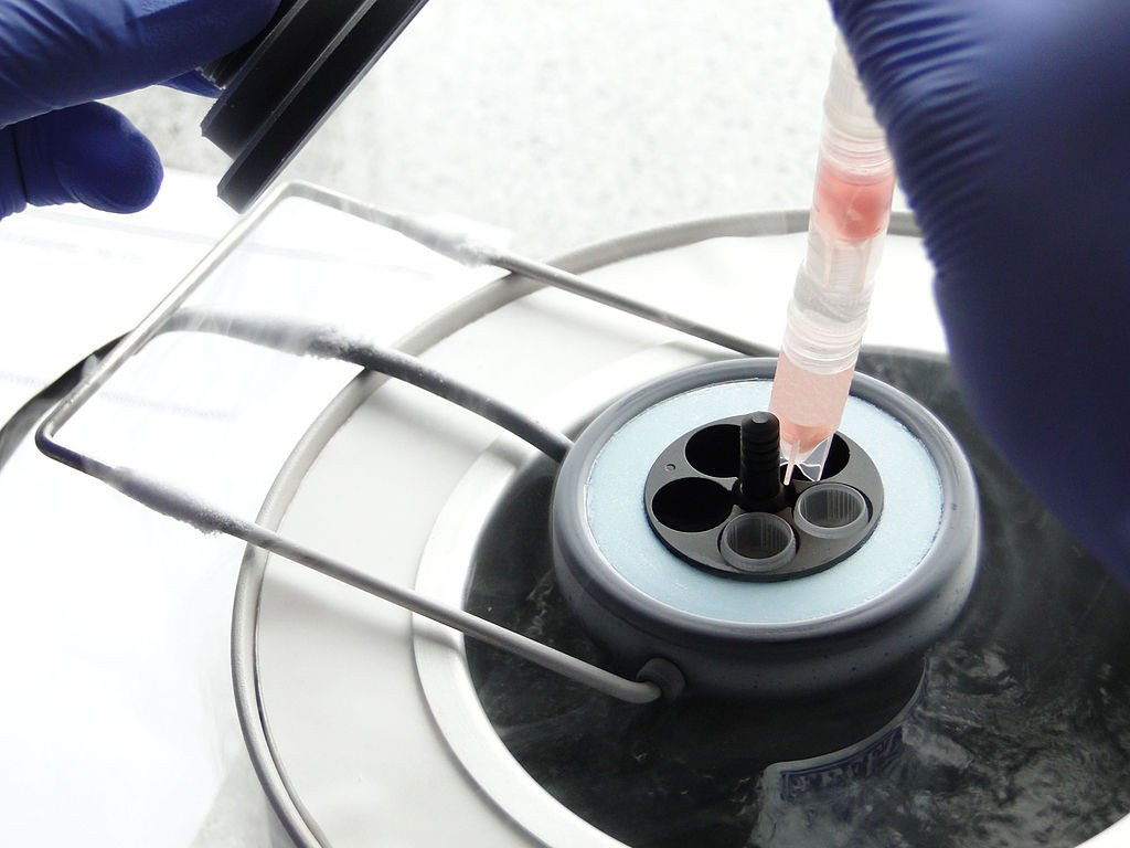 Cryopreserving ovarian tissue strips Cryopreservation Egg freezing