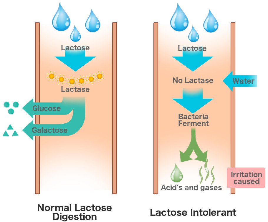 Lactose digestion lactose intolerant