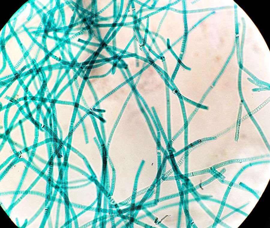 An image of Cyanobacteria, Tolypothrix