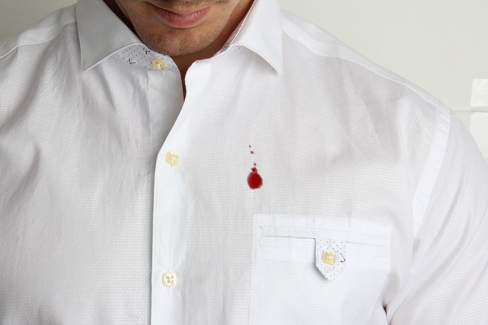 Blood stain on white shirt