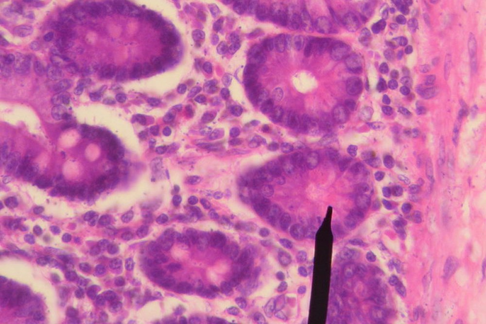 human paneth cell