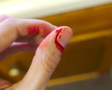 bleeding finger, blooding, injury, pain, hand