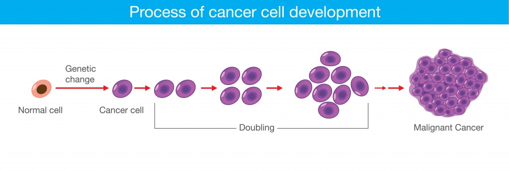 Process of cancer cell development. Medical illustration(solar22)S