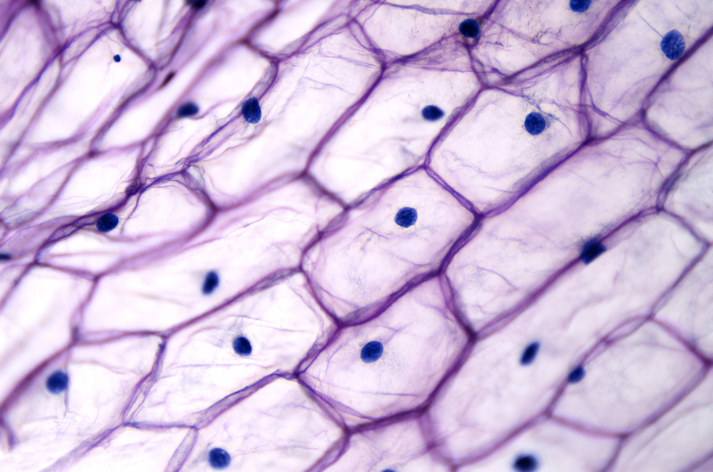 Onion epidermis with large cells under light microscope( Peter Hermes Furian)s