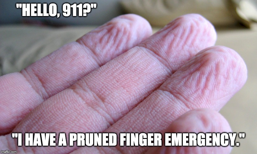 i have a pruned finger emergency meme
