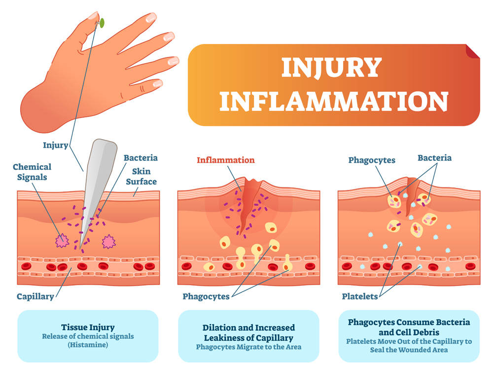 Injury inflammation biological human body response vector illustration scheme