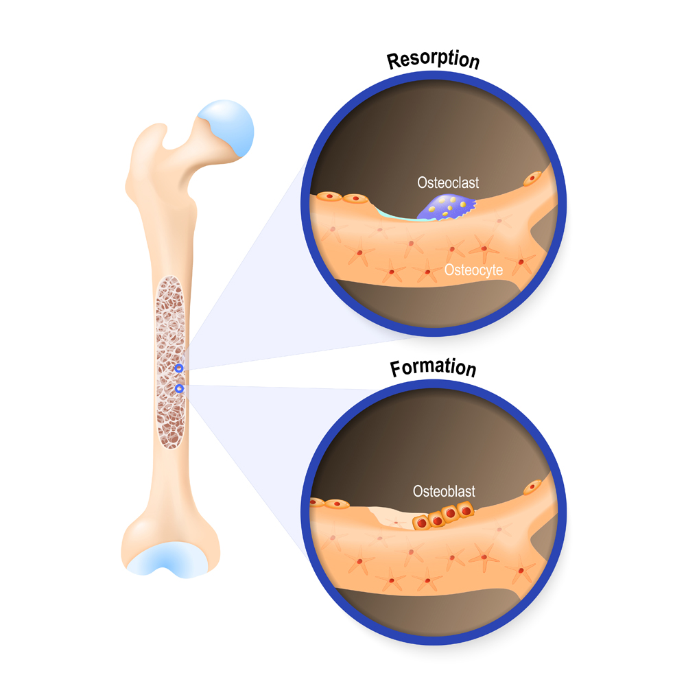 Osteoblast and osteoclast(Designua)s