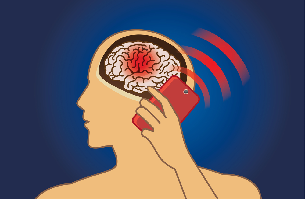 Brain damage from using mobile phone radiation in a long time(solar22)s