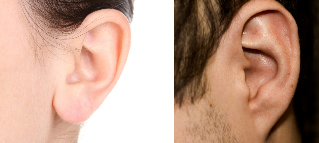 (Free (dominant) earlobes vs Attached (recessive) earlobes