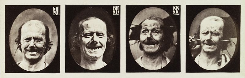 Four images of experiment on the electro-physiological Wellcome