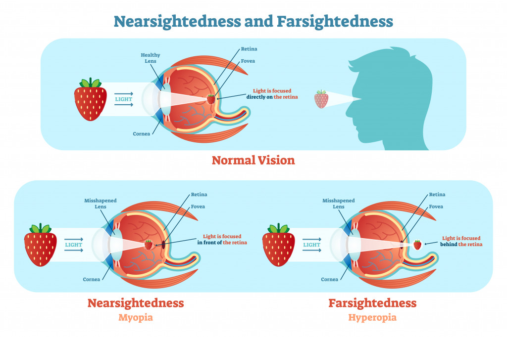 Far Sightedness and Near Sightedness vector illustration diagram
